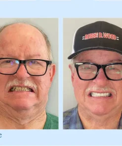 VivaDenta™ - Premium Denture
